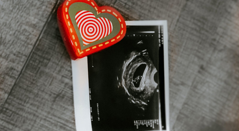 Ecografia pediatrica